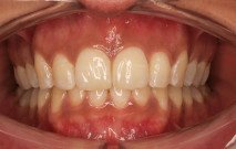 Aberdeen Dental Care - Invisalign