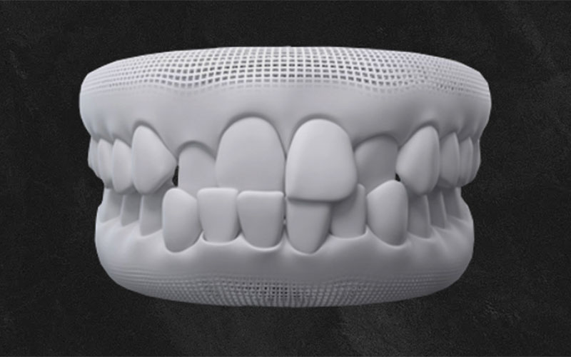 Aberdeen Dental Care - Invisalign